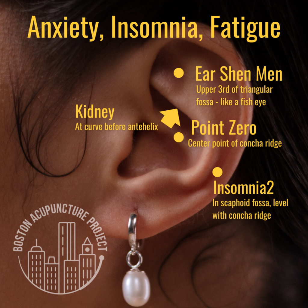 Photo of ear showing points. Title: Anxiety, Insomnia, Fatigue. Points labeled. Ear Shen Men: upper third of triangular fossa - like a fish eye. Point zero: center point of concha ridge. Insomnia2: in scaphoid fossa, level with concha ridge. Kidney: at curve before antehelix. Boston Acupuncture Project logo.